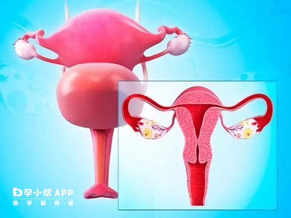 宫外孕HCG值44包块3cm可能会破裂