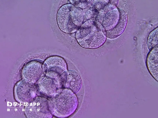 移植D3胚胎宫外孕几率不到5%