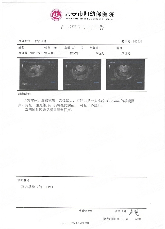 49岁H姐的孕期检查报告