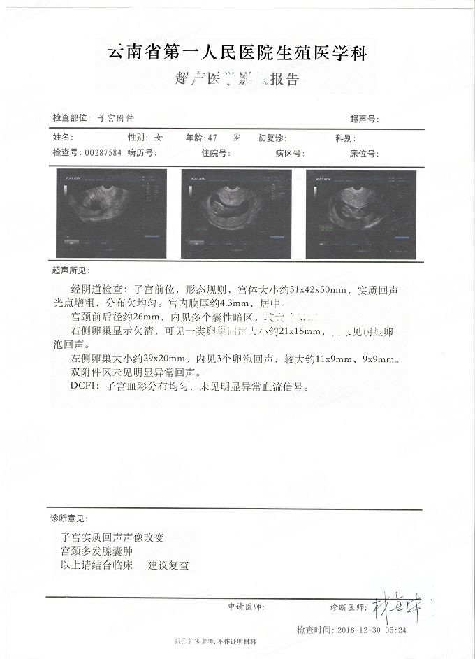 47岁试管婴儿检查基础卵泡