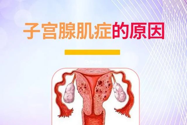 引起子宫腺肌症的原因