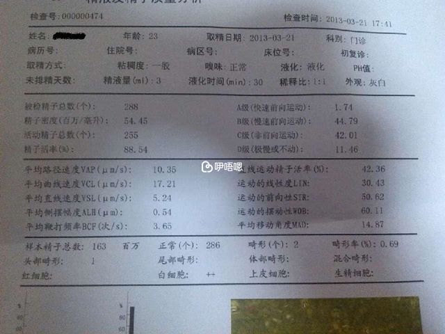 精液常规检查项目报告