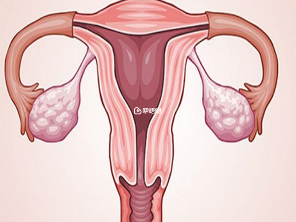 多囊卵巢综合征会导致试管成功率降低