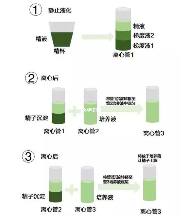 HIV洗精术的方法