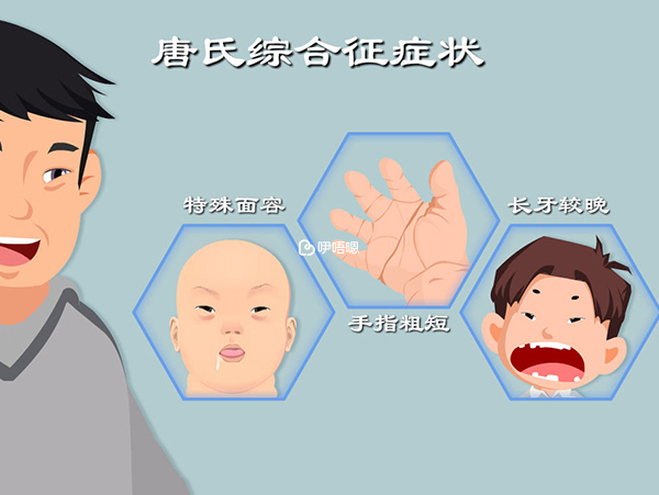 唐筛检查可筛检出60-70%的唐氏症患儿