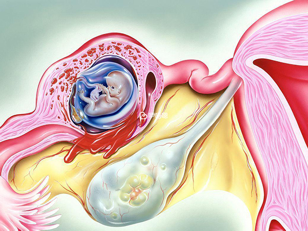 宫外孕的痛苦只有经历过得人才了解