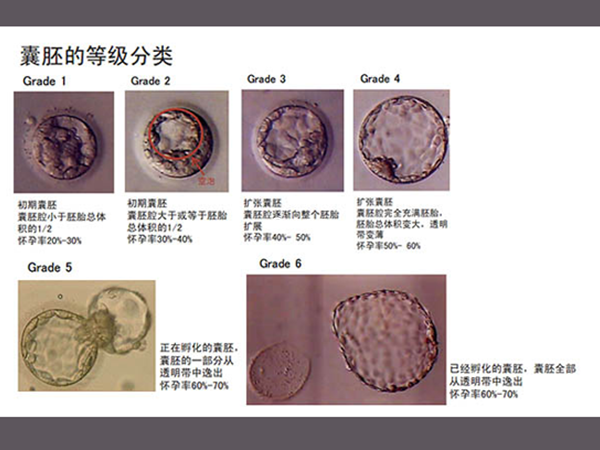 囊胚等级与妊娠率、妊娠继续率、流产率有关