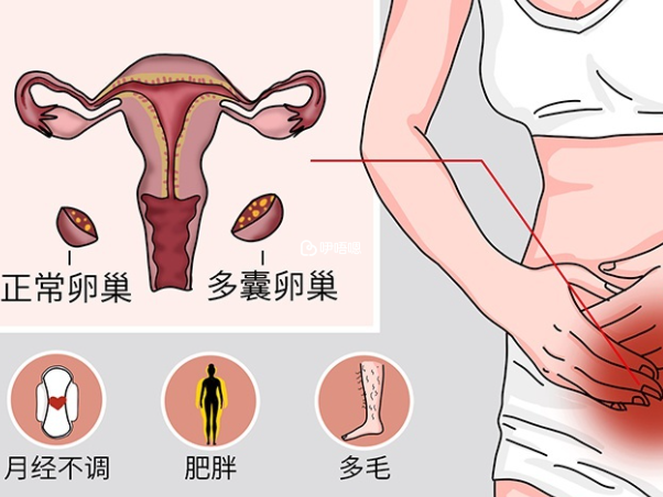 多囊吃达英可以把激素调理正常