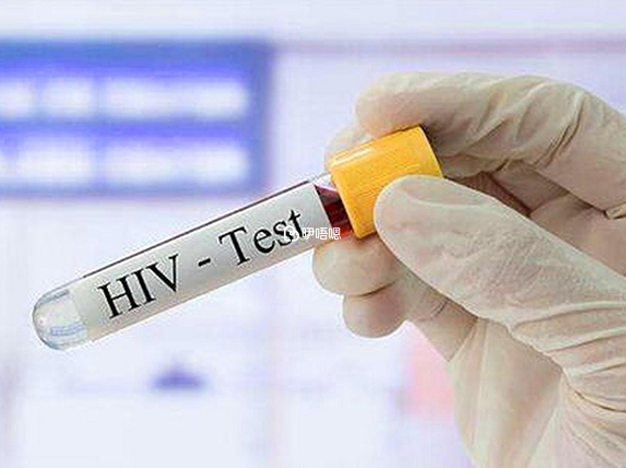 艾滋病（hiv）属于传染性疾病