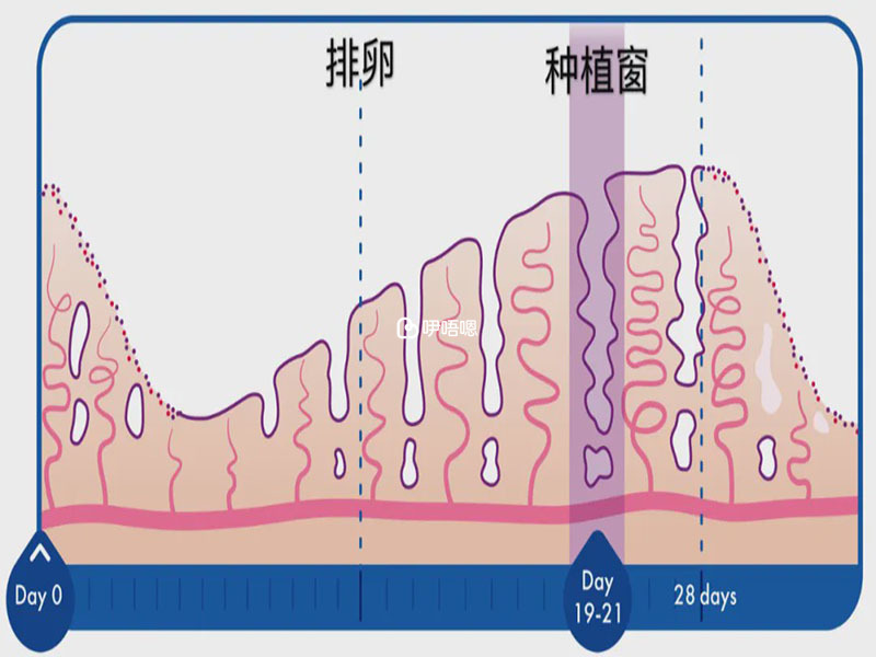 种植窗有没有必要做的情况