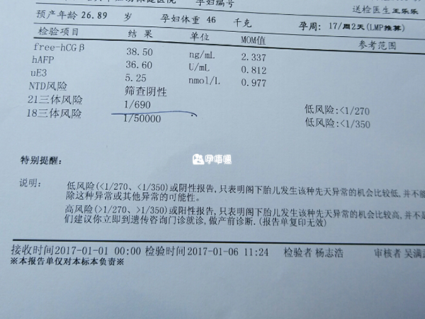 18三体可筛查染色体异常疾病