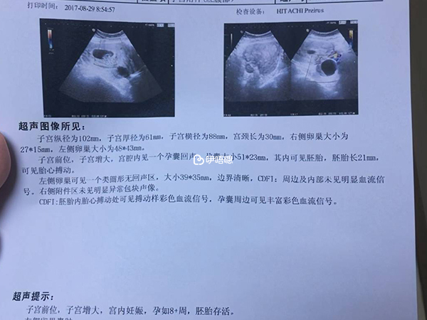 超声检查结果单