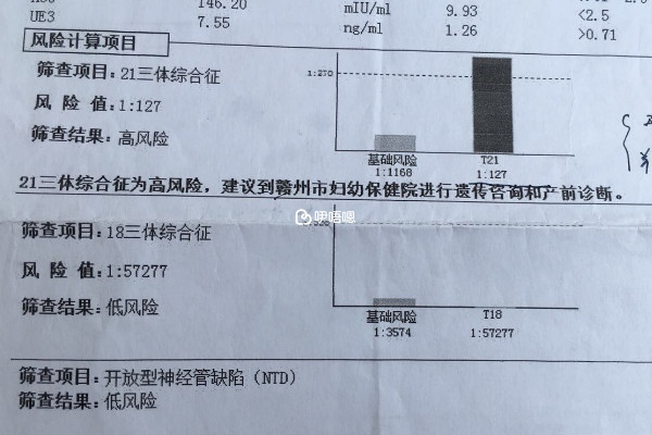 无创高风险的宝宝不一定是不健康的